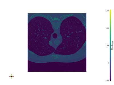 Baseline: pyvista-examples-downloads-download_chest-55f03f4397ed09b5_00_00_vtksz
