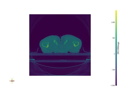 Baseline: pyvista-examples-downloads-download_prostate-2c6ca69db2a61e02_00_00_vtksz