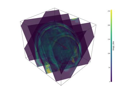 Baseline: sphx_glr_slice_007_vtksz